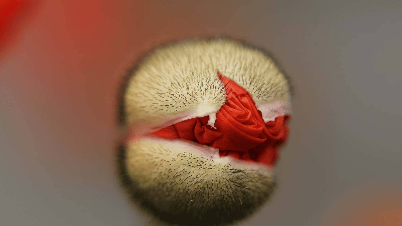 What Causes Hemorrhoids to Get Bigger? Heal Your Hemorrhoids